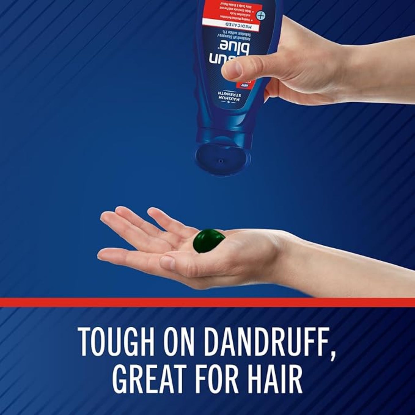 Selsun Blue- Shampoo,Antidandruff,Scalp Treatment With Selenium Sulfide- 325ml