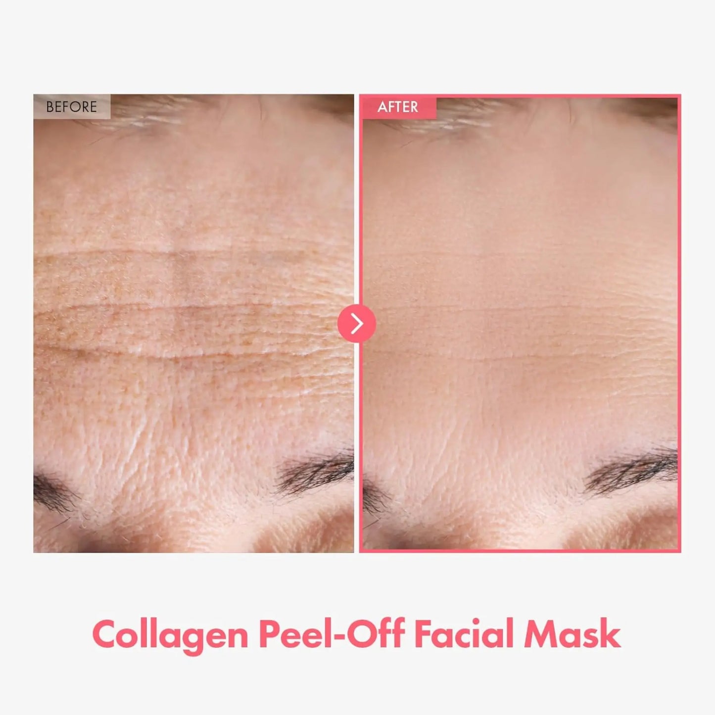 Before and after comparison of a collagen peel-off facial mask on skin with visible lines.