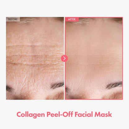 Before and after comparison of a collagen peel-off facial mask on skin with visible lines.