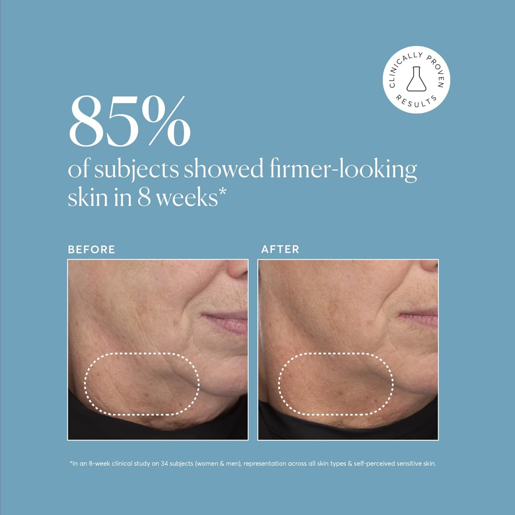 Before and after comparison of skin firmness with text on a blue background