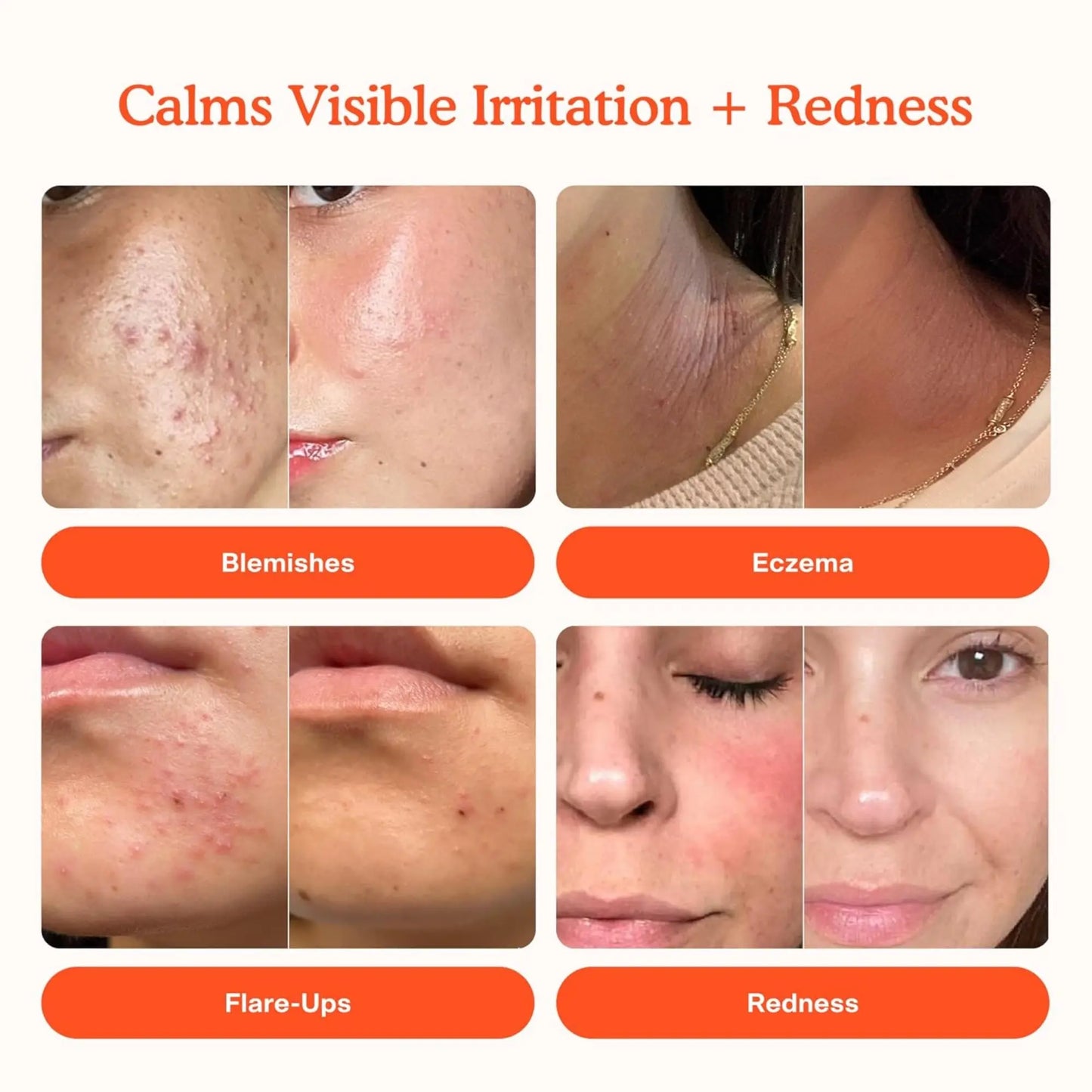 Collage of skin conditions with text indicating product benefits on a white background
