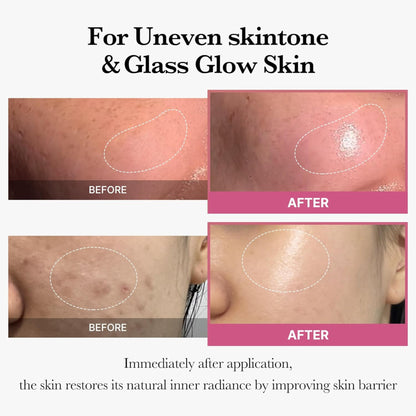 Before and after comparison of skin treatment for uneven skin tone and glass glow skin.