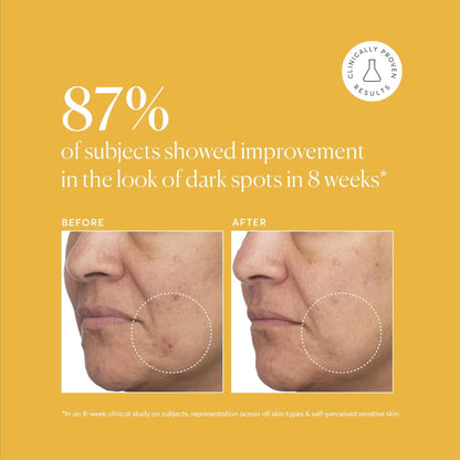 Advertisement showing before and after effects of a skincare product on dark spots with a yellow background.
