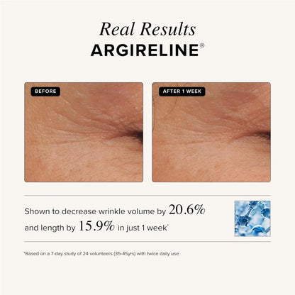 Argireline before and after skin treatment showing reduced wrinkles.