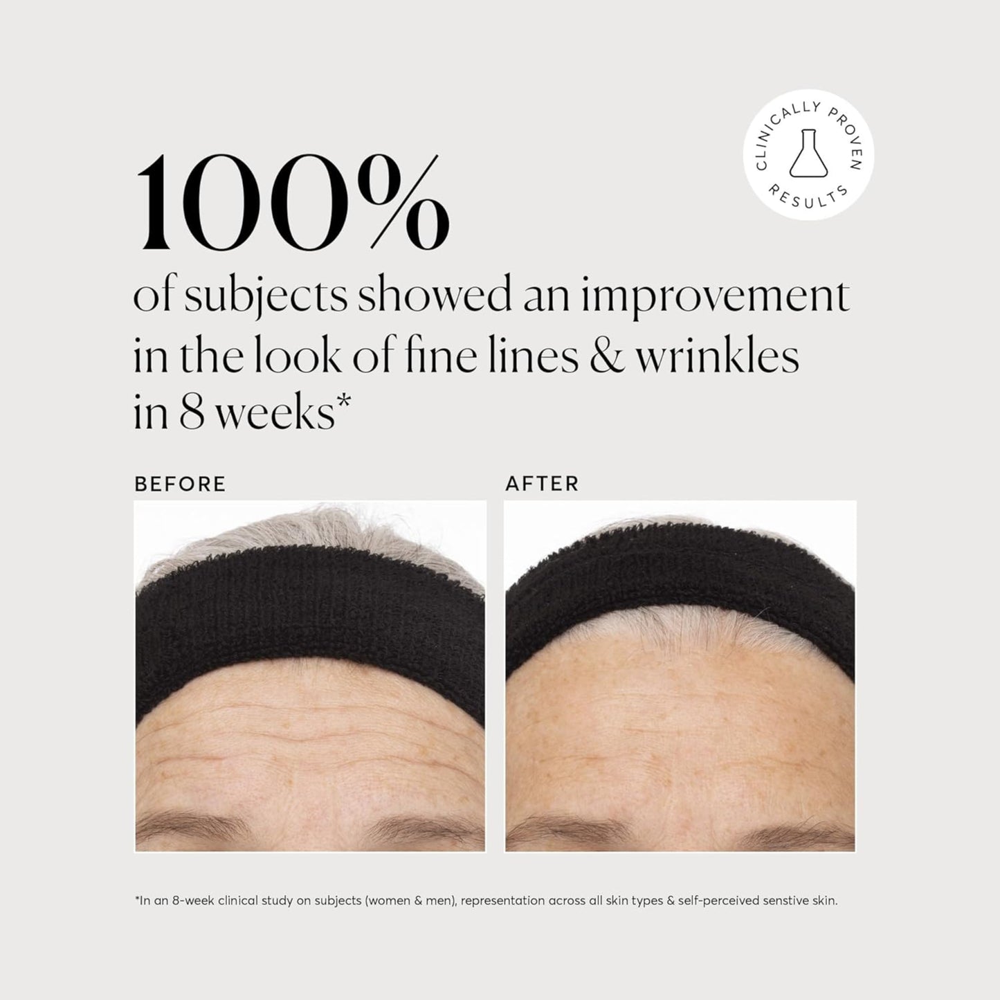 Before and after comparison of fine lines and wrinkles with a clinical study result on a light gray background.