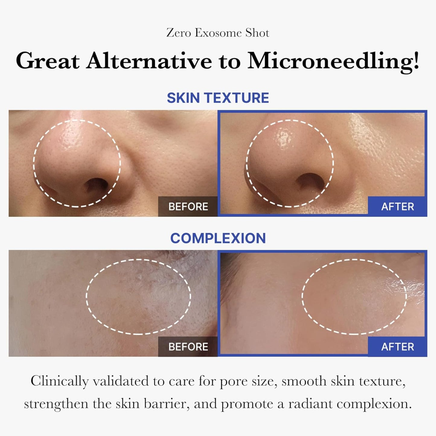 Medicube- Zero Exosome Shot 2,000 PPM Spicule Facial Serum -30ml