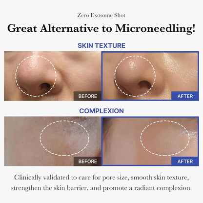 Medicube- Zero Exosome Shot 2,000 PPM Spicule Facial Serum -30ml