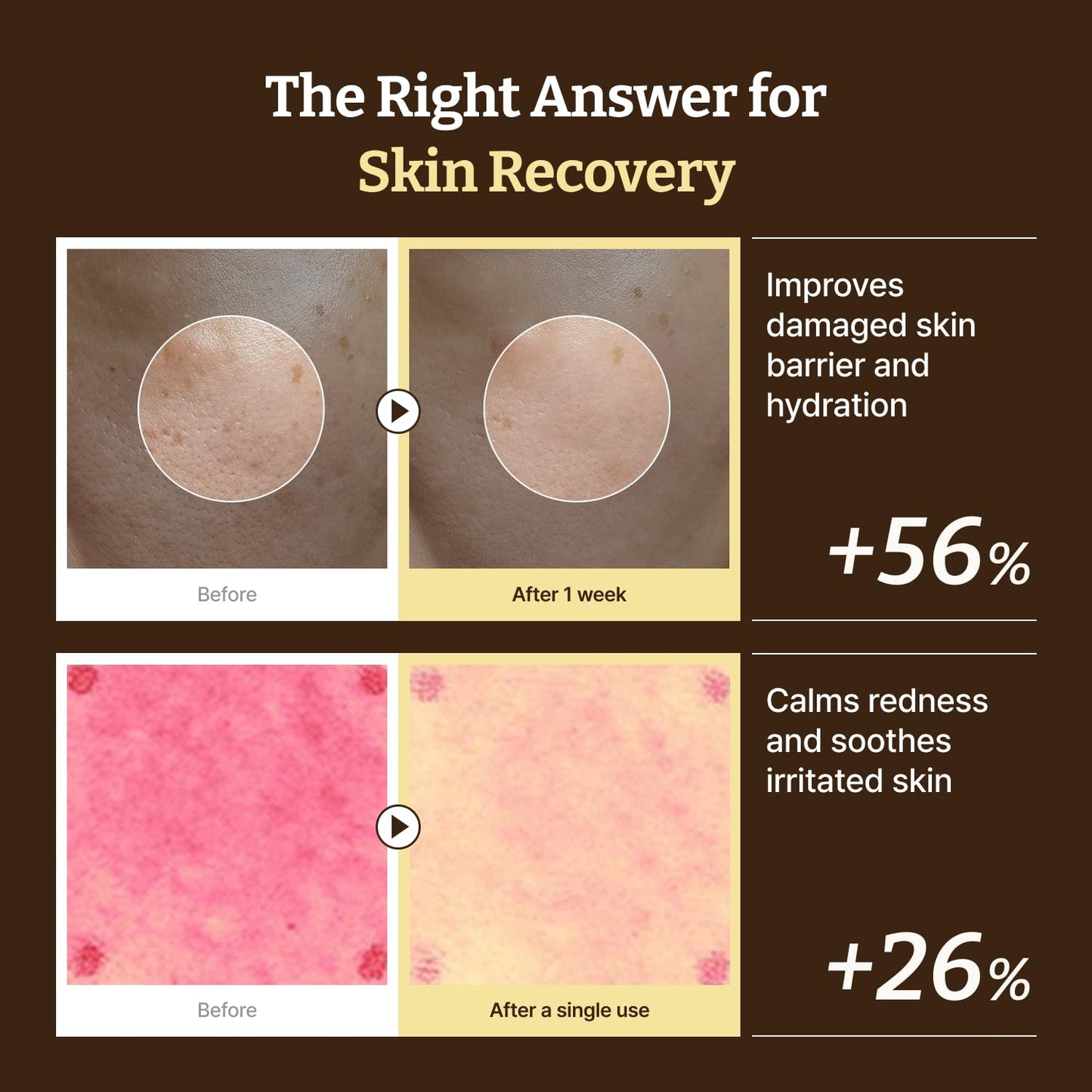 Dr. Reju-All Advanced PDRN Rejuvenating Cream, (USA Version)-20ml