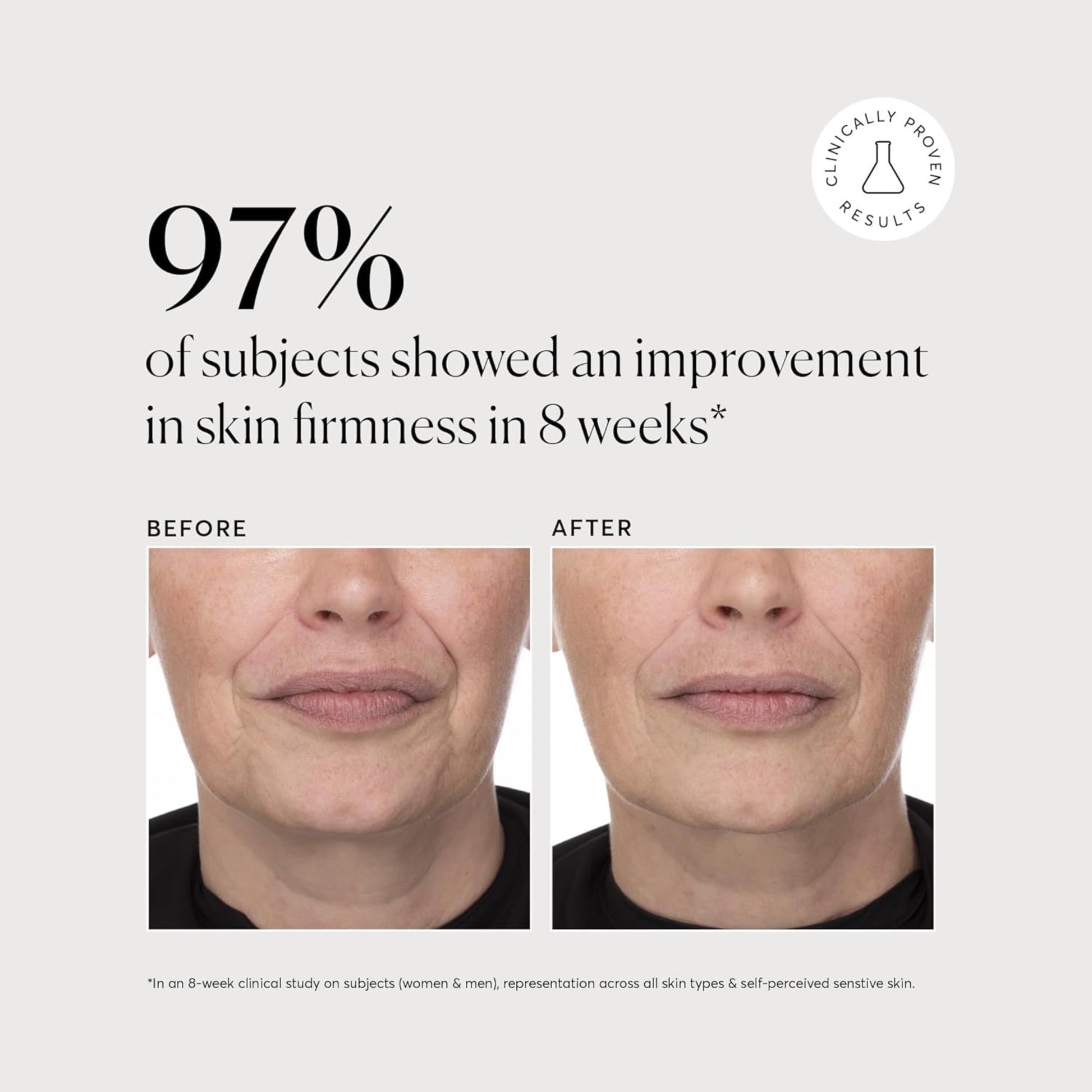 Before and after skin firmness improvement with clinical results shown.