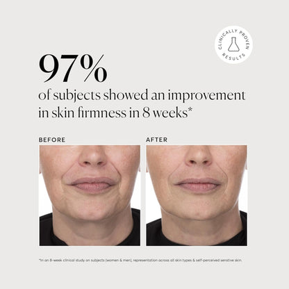Before and after skin firmness improvement with clinical results shown.