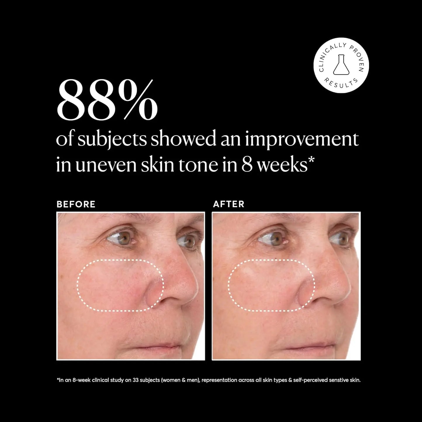 Naturium Vitamin C Super Serum Plus, Retinol, Hyaluronic Acid, Niacinamide & Salicylic Acid,30ml - Antiaging Cosmetics