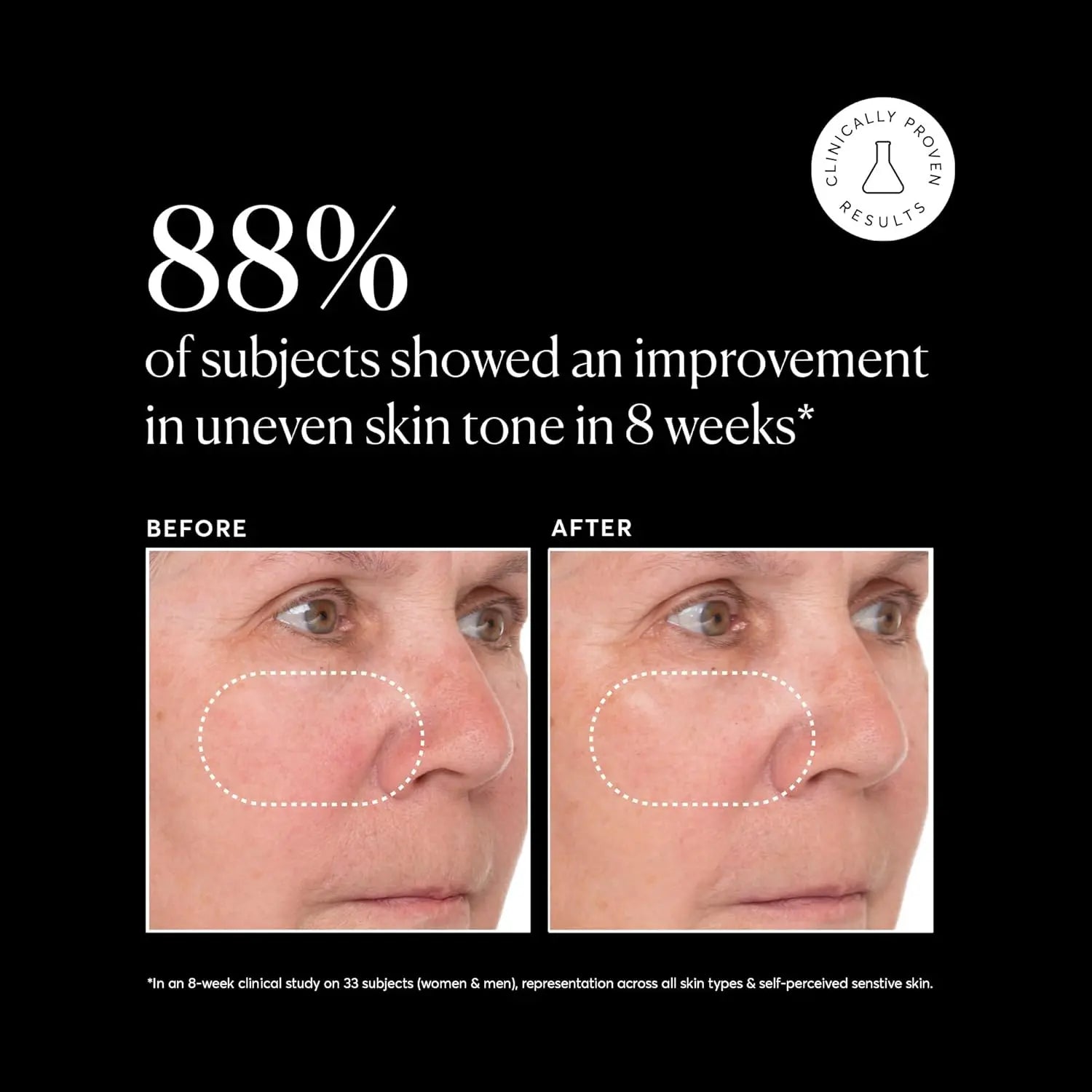 Naturium Vitamin C Super Serum Plus, Retinol, Hyaluronic Acid, Niacinamide & Salicylic Acid,30ml - Antiaging Cosmetics