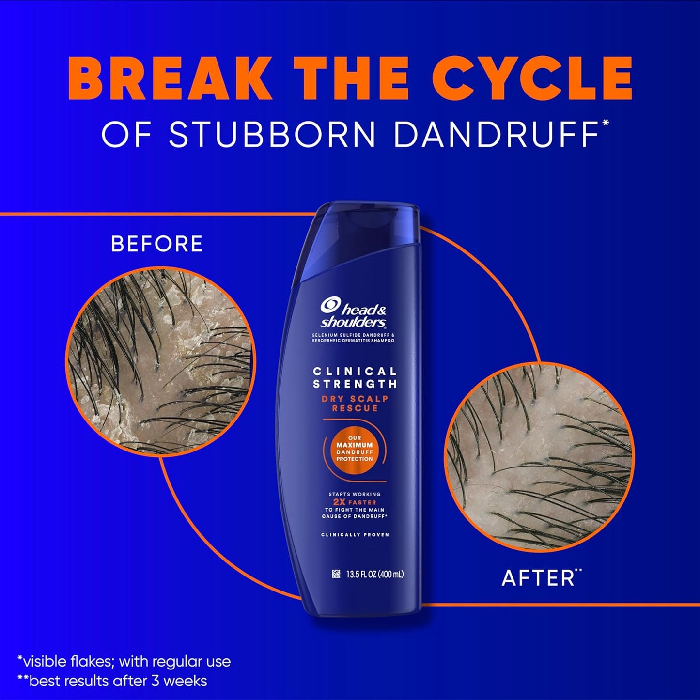 Head & Shoulders Clinical Dandruff Defense  for Dry Scalp Rescue Shampoo-400ml