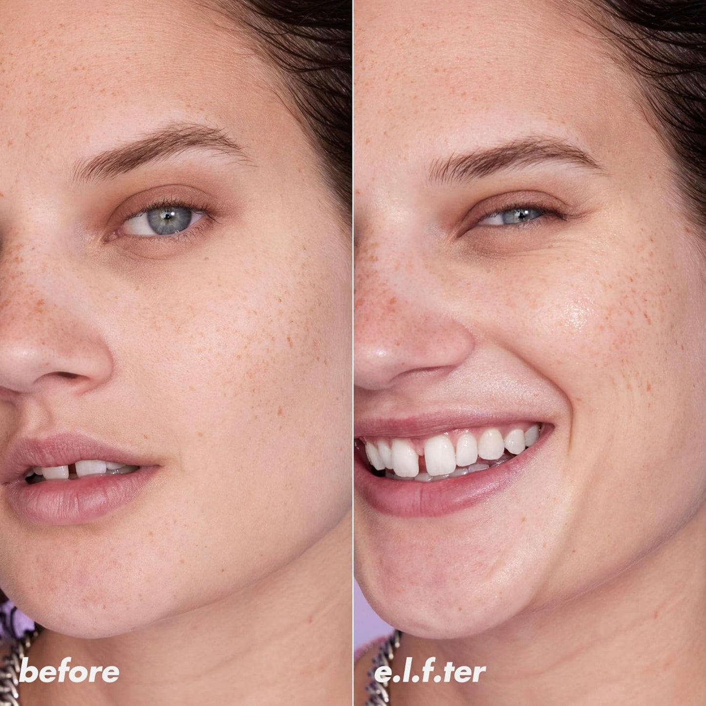 Before and after comparison of a woman's smile with visible teeth, labeled 'before' and 'e.l.f.ter'.