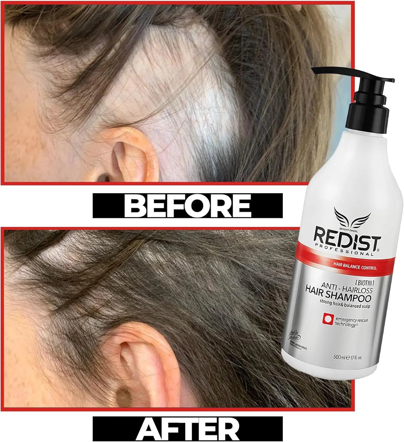 Redist Anti Hair Loss Shampoo 500ml Strengthening Nourishing Shampoo for Thinning Hair,500ml Redist