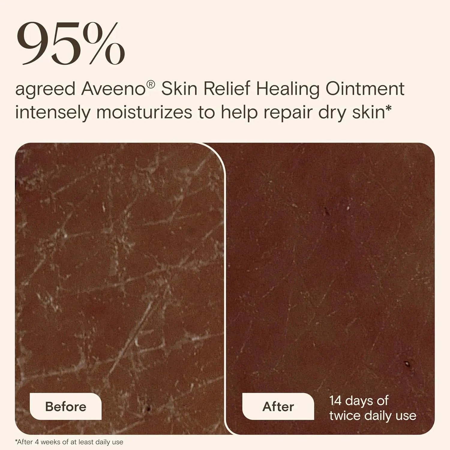 Before and after comparison of Aveeno Skin Relief Healing Ointment on dry skin with text indicating effectiveness.