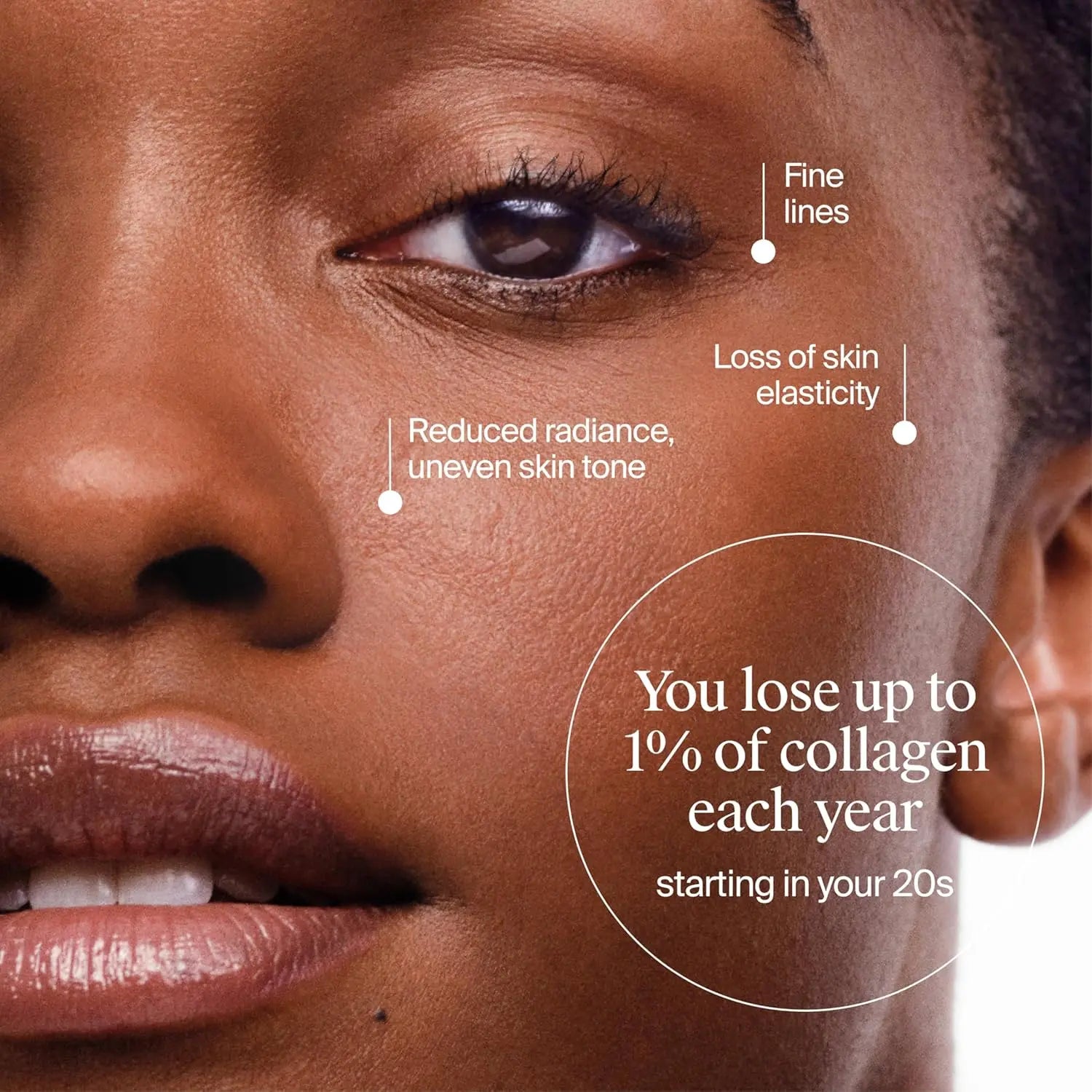 Close-up of a woman's face with text about collagen loss, used for educational or promotional purposes.