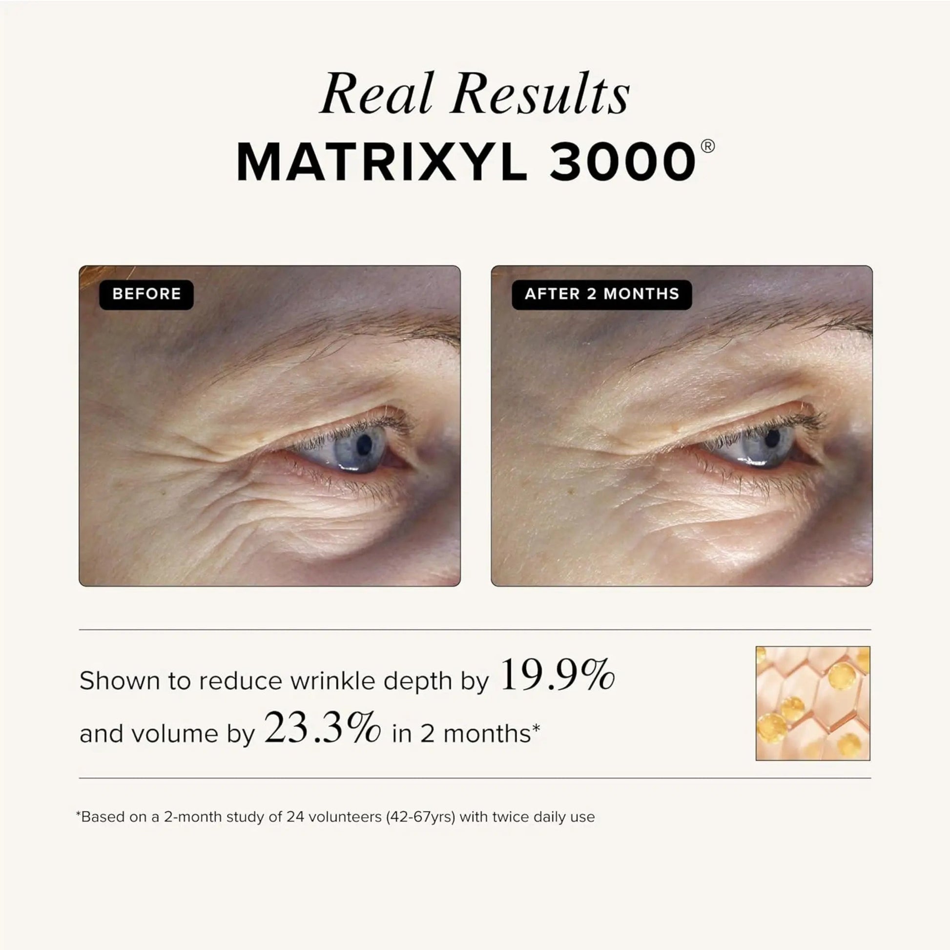 Asterwood - Triple Repair Matrixyl 3000 + Argireline - 1 fl oz (29ml) - Antiaging Cosmetics