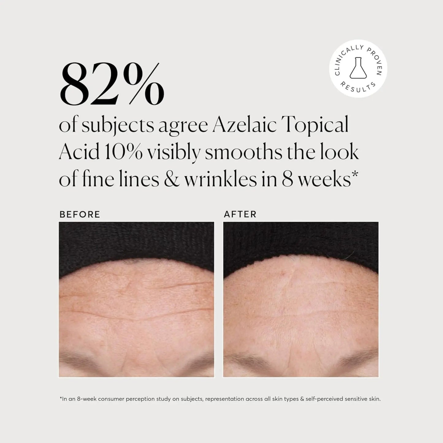 Azelaic Acid , Topical , by Naturium , 10% serum - 30ml - Antiaging Cosmetics