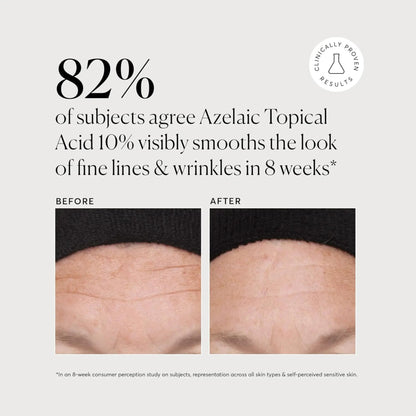 Azelaic Acid , Topical , by Naturium , 10% serum - 30ml - Antiaging Cosmetics