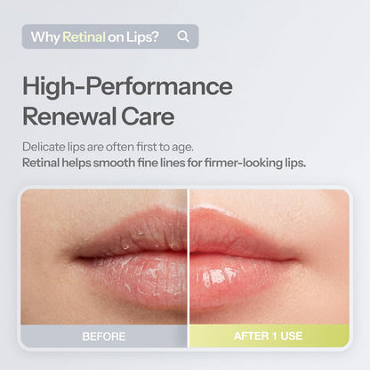 Dr.Different Retinal Lip Balm Clear – Peptide Lip Care, 4 g - Antiaging Cosmetics
