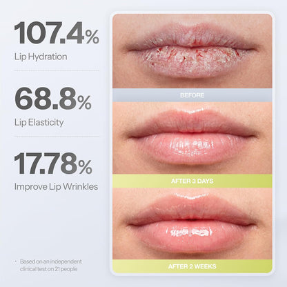 Dr.Different Retinal Lip Balm Clear – Peptide Lip Care, 4 g - Antiaging Cosmetics