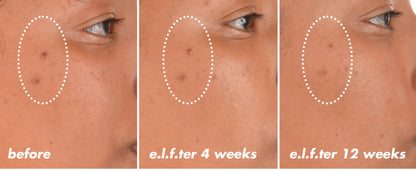 ELF SKIN serum Bright Icon Vitamin C + E + Ferulic Serum - 1 fl oz (30ml) - Antiaging Cosmetics
