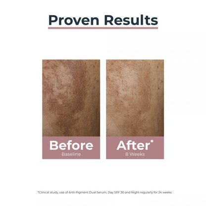 Eucerin Anti-Pigment ,Dual Serum Dark Spots 30ml (Europe version)