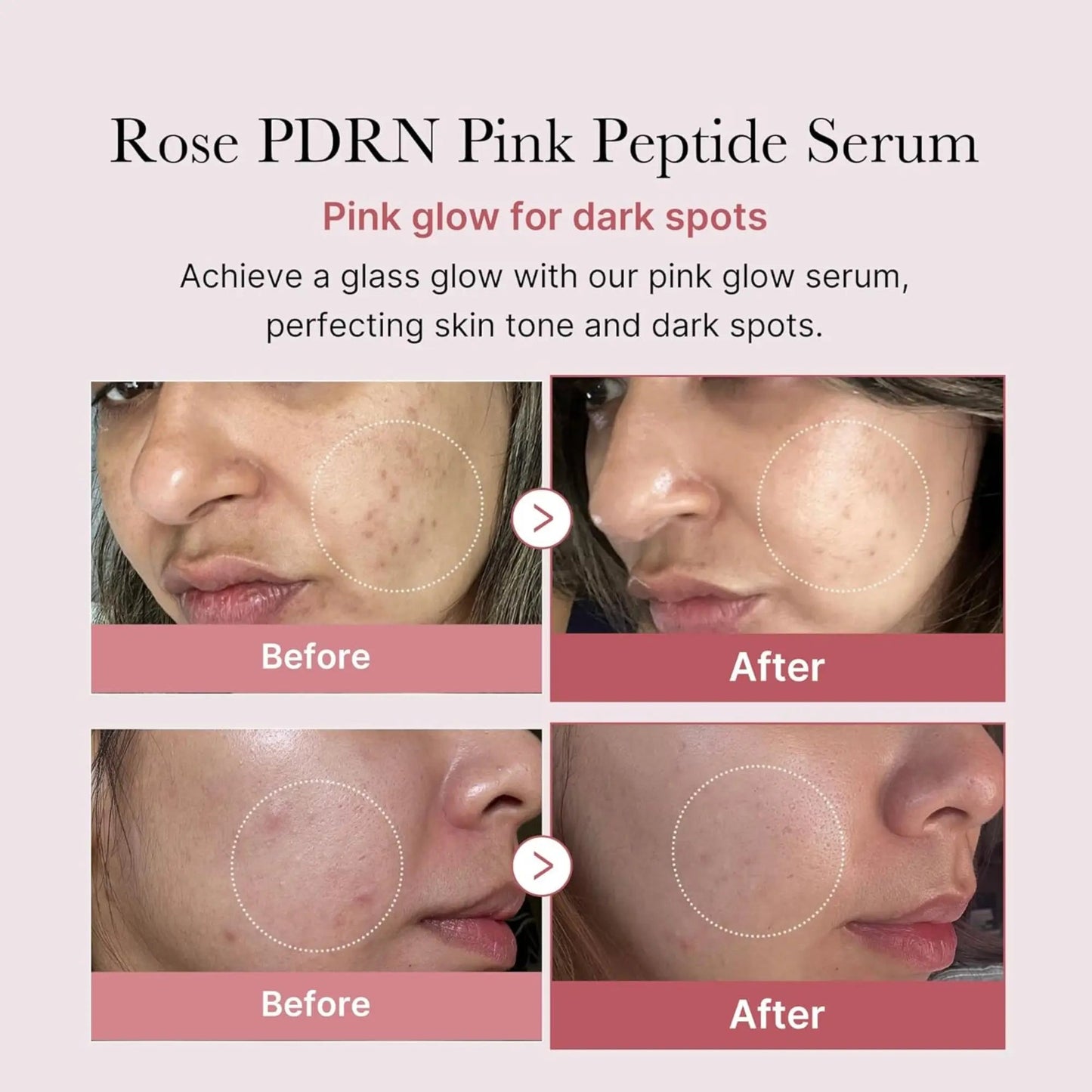 Medicube - PDRN Pink Peptide Serum - 30gr - Antiaging Cosmetics