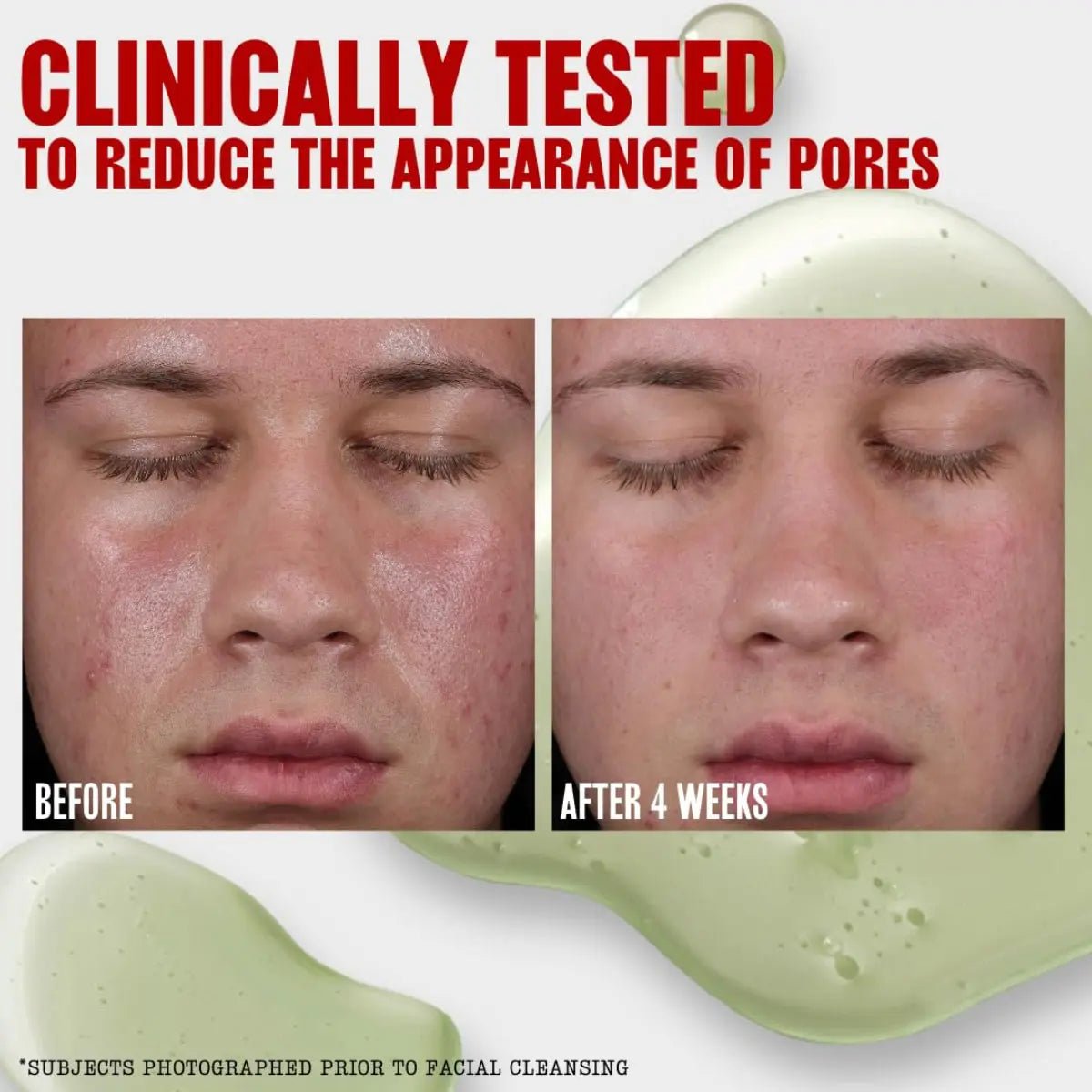 Thayers Oil Absorbing Toner, Pore Reducing Facial Toner - 355ml - Antiaging Cosmetics