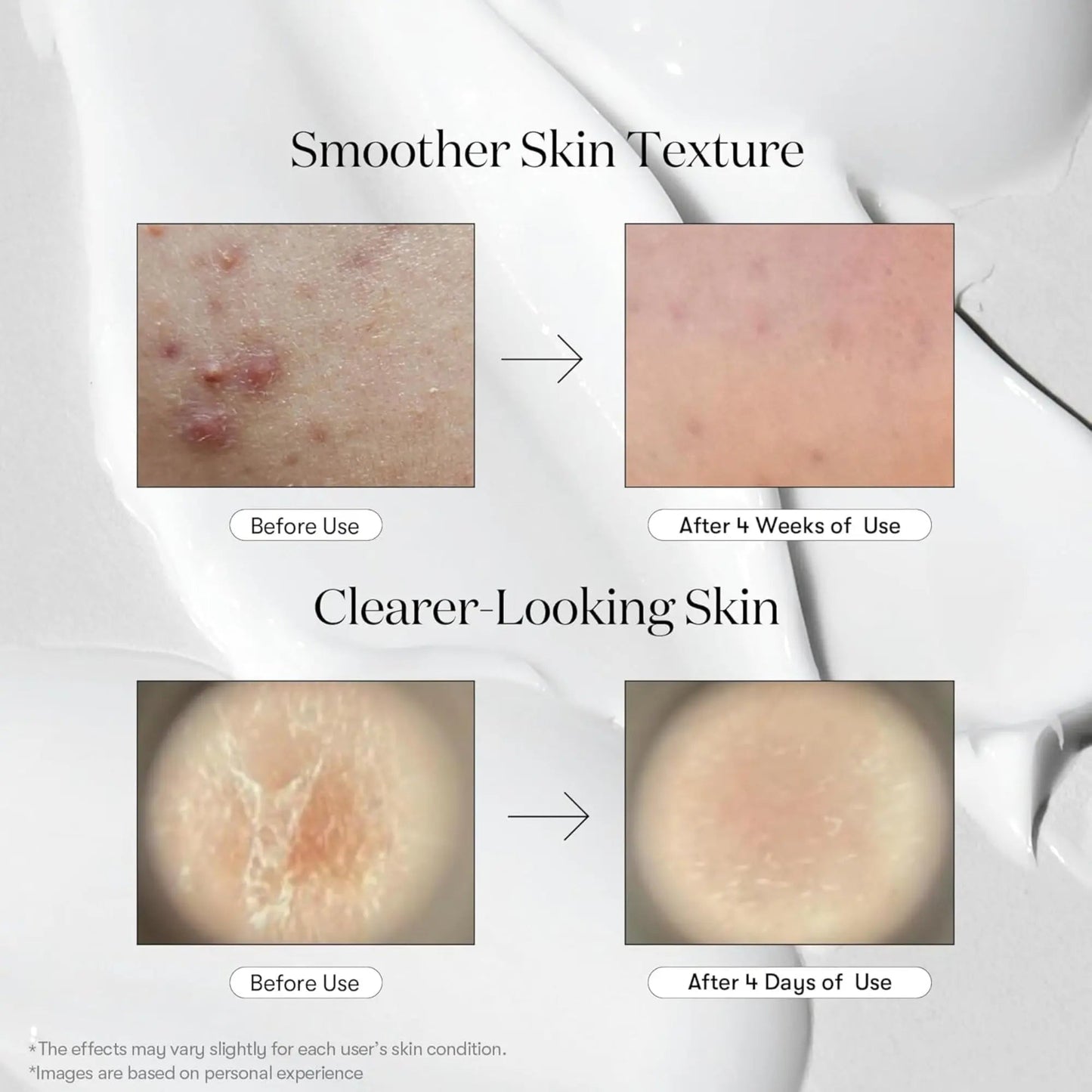 VT COSMETICS - REEDLE Shot, Liquid Microneedling with Exosome - 50ml - Antiaging Cosmetics