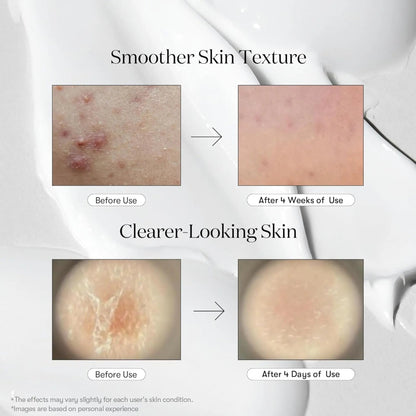 VT COSMETICS - REEDLE Shot, Liquid Microneedling with Exosome - 50ml - Antiaging Cosmetics