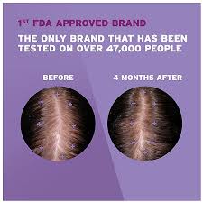 Walgreens Women's 5% Minoxidil Foam Hair Regrowth Treatment 180 Day Supply, 3 pack - Antiaging Cosmetics